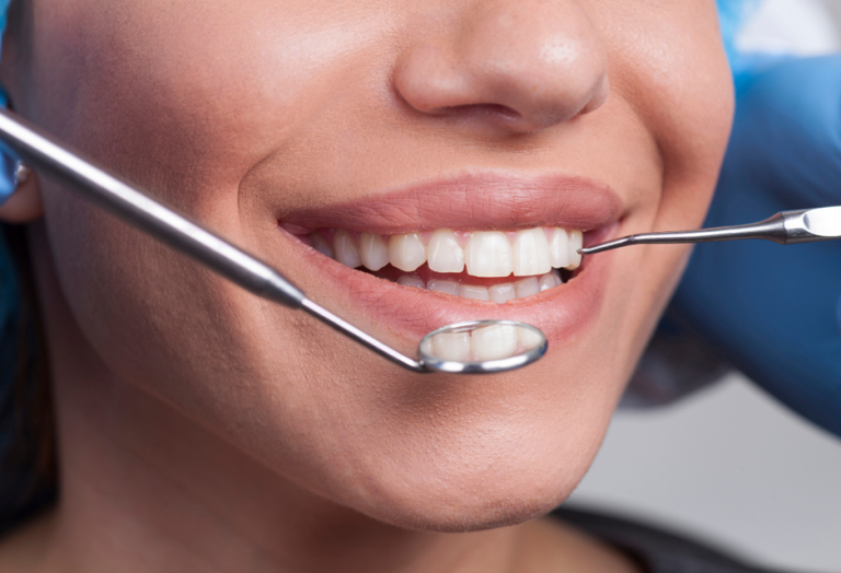 “Ψηφιακή Αισθητική Οδοντιατρική και Ευαισθησία: Από το DigitalSmileDesign σε στοχευμένη προστασία σμάλτου”