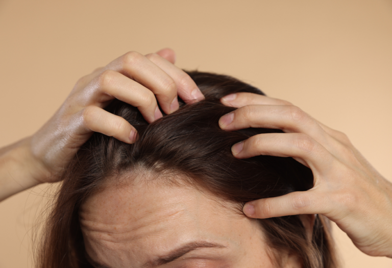 “Γυναικεία τριχόπτωση: Μην πανικοβάλλεσαι, δες τι πραγματικά φταίει και πώς αντιμετωπίζεται”
